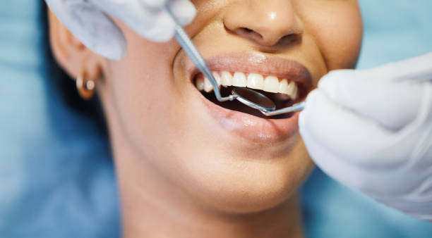 Best Emergency Wisdom Teeth Removal in Lake Of The Woods, VA
