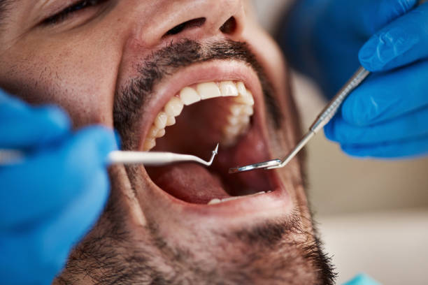 Best Emergency Root Canal Treatment in Lake Of The Woods, VA